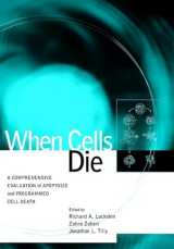 When Cells Die: A Comprehensive Evaluation of Apoptosis and Programmed Cell Death
