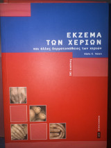 Έκζεμα των χεριών