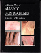 A Colour Atlas of Allergic Skin Disorders