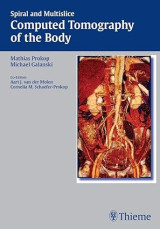 Spiral and Multislice Computed Tomography of the Body