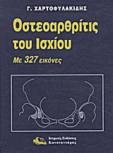 Οστεοαρθρίτις του ισχίου: Με 327 εικόνες