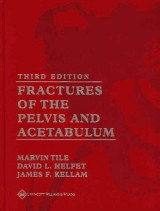 Fractures of the Pelvis and Acetabulum