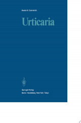 Urticaria
