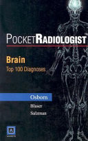 Brain