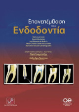 Επέμβαση στην ενδοδοντία