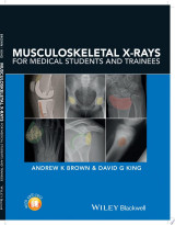 Musculoskeletal X-Rays for Medical Students and Trainees