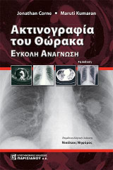 Ακτινογραφία του θώρακα: Εύκολη ανάγνωση