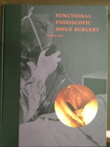 Functional Endoscopic Sinus Surgery